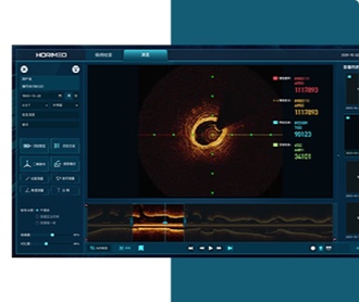 恒宇醫療OCT系統醫療影像軟件界面設計