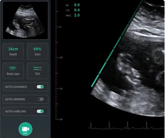 某人工智能研究所醫療影像軟件UI設計（保密）